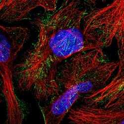 TCTN1 Antibody, Novus Biologicals 0.1mL; Unlabeled:Antibodies, Polyclonal